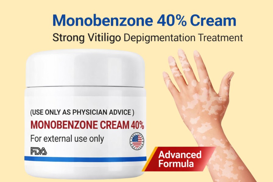 Monobenzone 40% Cream – Strong Depigmentation Treatment for Extensive Vitiligo