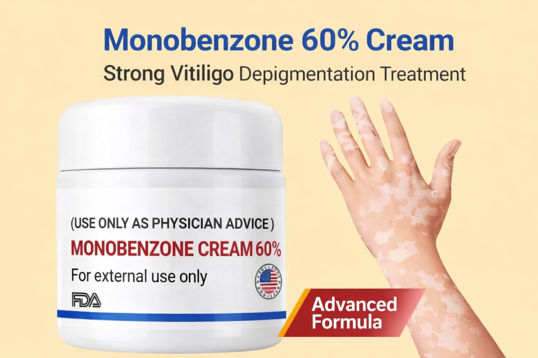 High-Strength Monobenzone 60% Cream for Vitiligo Skin Lightening